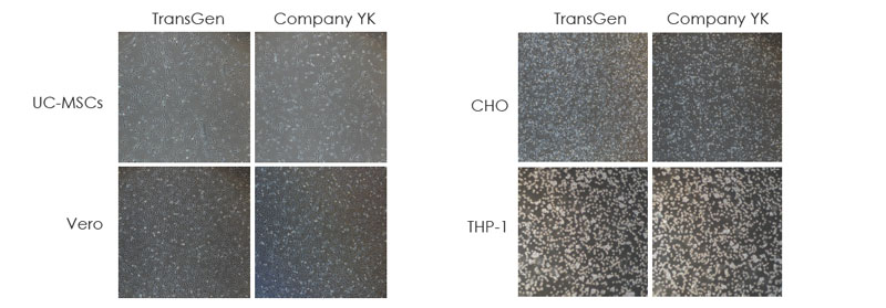 使用TransGen 凍存液和Company YK 無DMSO 無蛋白凍存液在-80℃凍存1 個(gè)月的多種細(xì)胞復(fù)蘇24 小時(shí)后細(xì)胞貼壁情況的比較
